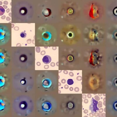 Generative AI Model Identifies Abnormalities in Blood Cells – Physics World - Tech Digital Minds