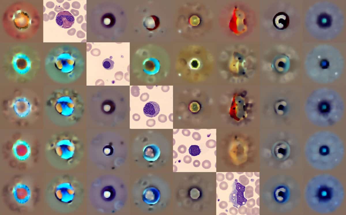 Generative AI Model Identifies Abnormalities in Blood Cells – Physics World - Tech Digital Minds